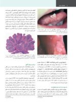 پاتولوژی دهان، فک و صورت نویل 2024 (جلد دوم) - Image 7