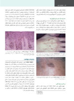 پاتولوژی دهان، فک و صورت نویل 2024 (جلد دوم) - Image 9