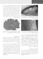 پاتولوژی دهان، فک و صورت نویل 2024 (جلد دوم) - Image 13