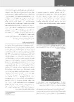 پاتولوژی دهان، فک و صورت نویل 2024 (جلد دوم) - Image 11