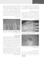 پاتولوژی دهان، فک و صورت نویل 2024 (جلد دوم) - Image 12