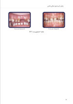 پایان دادن به پوسیدگی دندانی در کودکان - Image 6