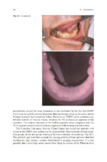 Clinical Management of Salivary Gland Disorders 2024 - Image 3