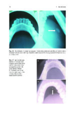 Clinical Management of Salivary Gland Disorders 2024 - Image 4
