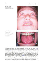 Clinical Management of Salivary Gland Disorders 2024 - Image 5