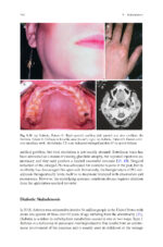 Clinical Management of Salivary Gland Disorders 2024 - Image 7