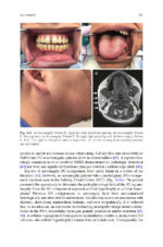 Clinical Management of Salivary Gland Disorders 2024 - Image 8