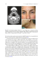 Clinical Management of Salivary Gland Disorders 2024 - Image 9