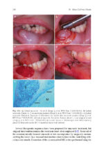 Clinical Management of Salivary Gland Disorders 2024 - Image 10