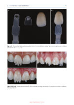 Color Science and Shade Selection in Operative Dentistry 2022 - Image 2