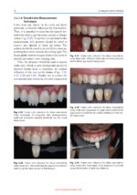 Color Science and Shade Selection in Operative Dentistry 2022 - Image 10