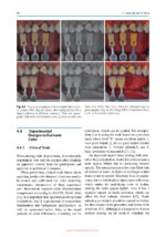 Color Science and Shade Selection in Operative Dentistry 2022 - Image 9