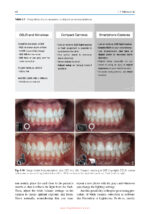 Color Science and Shade Selection in Operative Dentistry 2022 - Image 8