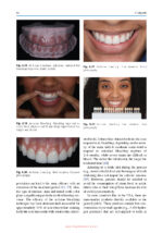 Color Science and Shade Selection in Operative Dentistry 2022 - Image 7