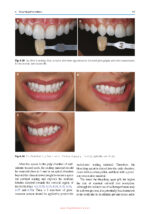 Color Science and Shade Selection in Operative Dentistry 2022 - Image 5
