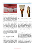 Color Science and Shade Selection in Operative Dentistry 2022 - Image 3