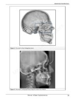 A Comprehensive Manual of Basic CephalometricAnalysis 2025 - Image 2