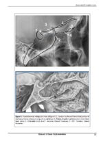 A Comprehensive Manual of Basic CephalometricAnalysis 2025 - Image 4