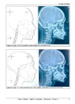 A Comprehensive Manual of Basic CephalometricAnalysis 2025 - Image 6