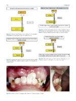 Clinical Cases in Early Orthodontic Treatment 2022 - Image 8