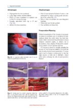 Complex Head and Neck Microvascular Surgery 2023 - Image 2