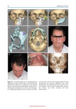 Complex Head and Neck Microvascular Surgery 2023 - Image 3