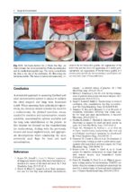 Complex Head and Neck Microvascular Surgery 2023 - Image 5