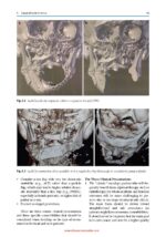 Complex Head and Neck Microvascular Surgery 2023 - Image 7