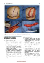 Complex Head and Neck Microvascular Surgery 2023 - Image 8