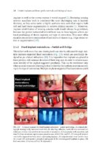 Dental Implants and Bone Grafts 2020 - Image 5
