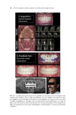 Dental Implants and Bone Grafts 2020 - Image 6