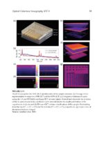 Optical Coherence Tomography in Dentistry 2024 - Image 4