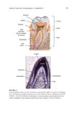 Optical Coherence Tomography in Dentistry 2024 - Image 5