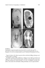 Optical Coherence Tomography in Dentistry 2024 - Image 6