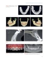 Passive Self Ligation from A to Z (Balut, 2022) - Image 11
