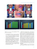 Passive Self Ligation from A to Z (Balut, 2022) - Image 10