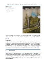 Peri-Implant Soft Tissue Management 2023 - Image 3