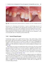 Peri-Implant Soft Tissue Management 2023 - Image 5