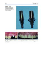 Peri-Implant Soft Tissue Management 2023 - Image 7