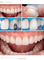 Quintessence of Dental Technology (QDT 2) 2024 - Image 3