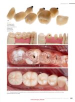 Quintessence of Dental Technology (QDT 2) 2024 - Image 4