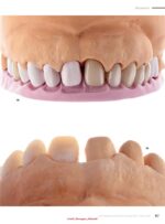 Quintessence of Dental Technology (QDT 2) 2024 - Image 8