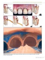 Quintessence of Dental Technology (QDT) 2021 - Image 6