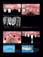 Quintessence of Dental Technology (QDT) 2021 - Image 4