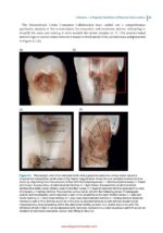 Vital Pulp Treatment  2024 - Image 8