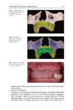 Zygomatic Implants Optimization & Innovation 2020 - Image 2
