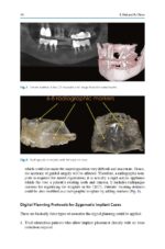 Zygomatic Implants Optimization & Innovation 2020 - Image 3