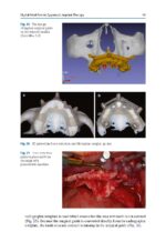 Zygomatic Implants Optimization & Innovation 2020 - Image 5