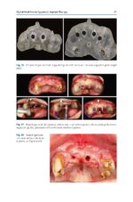 Zygomatic Implants Optimization & Innovation 2020 - Image 6