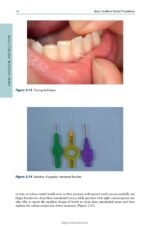 Basic Guide to Dental Procedures 2024 - Image 4